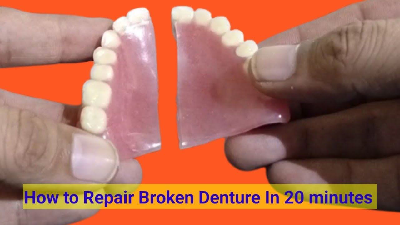 Broken Denture Repair in 20 minutes ||How to Repair Broken Denture In 20 minutes By Haider.dentures