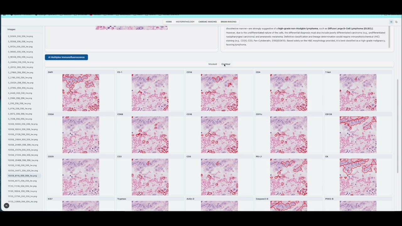 MEDICAL AI - AI for Multiplex Immunofluorescence in Histopathology
