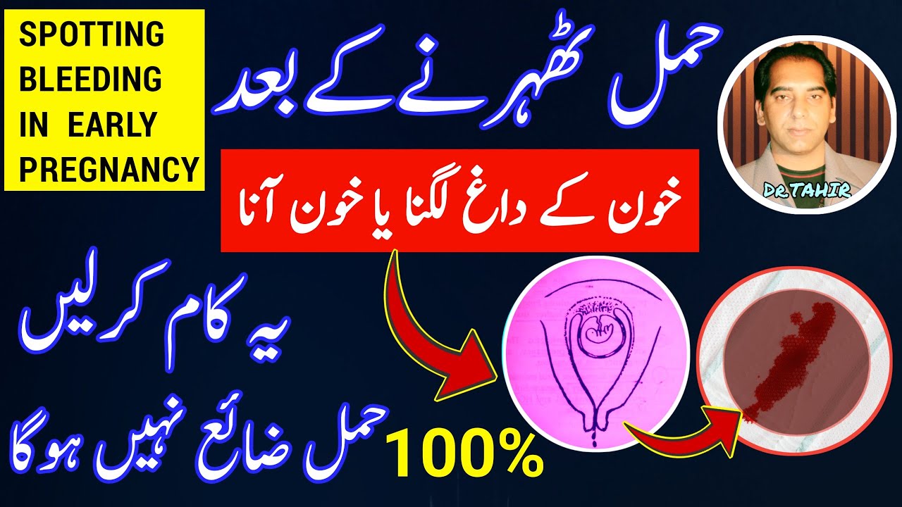 Bleeding in Pregnancy |Spotting in Early Pregnancy |Miscarriage Blood |Pregnancy Bleeding