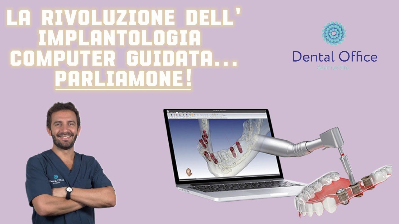 IMPLANTOLOGIA guidata o tradizionale? Quando conviene davvero usarla