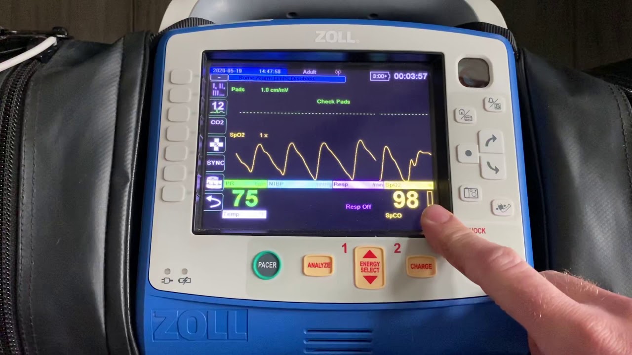 ZOLL X Series Perfusion Index-ZOLL Tips and Tricks