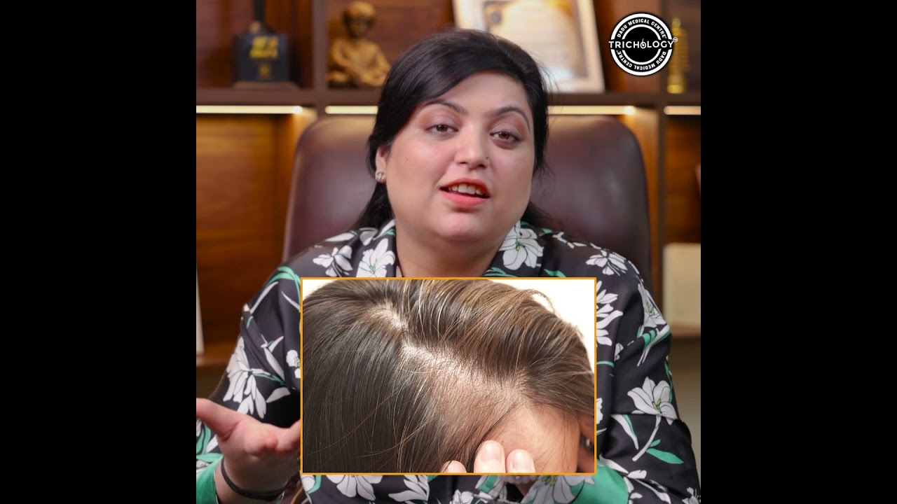 Females: Hair Loss? Causes, Symptoms, & Treatment