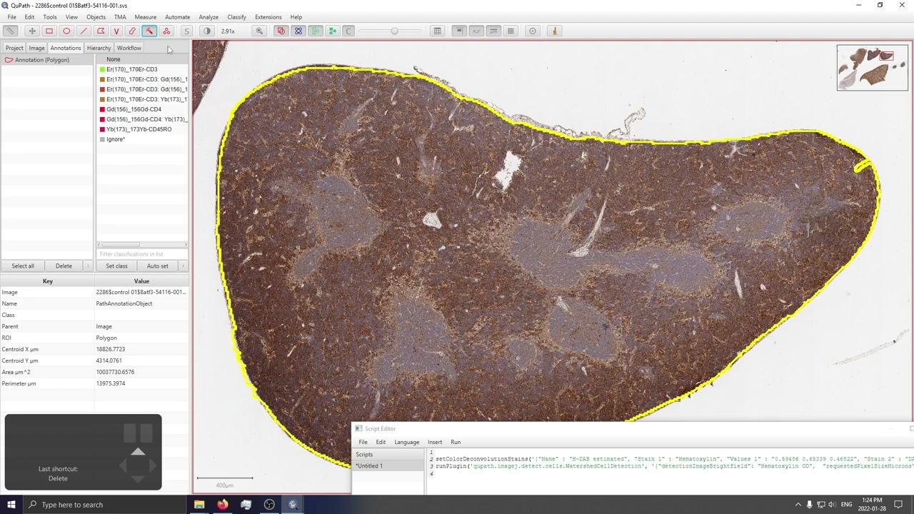 Cell Counting in QuPath