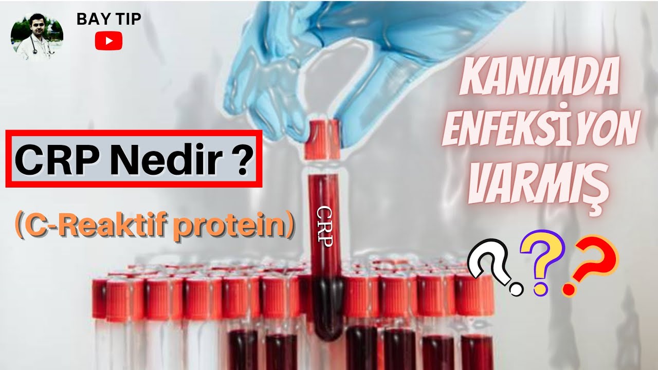 CRP NEDİR? C-REAKTİF PROTEİN NEDİR? KANDA ENFEKSİYON DEĞERİ NEDİR?