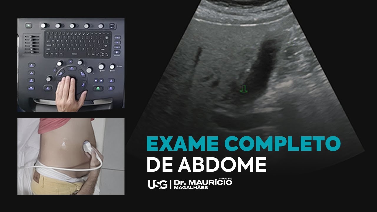 Ultrassonografia do abdome - variante de biotipo
