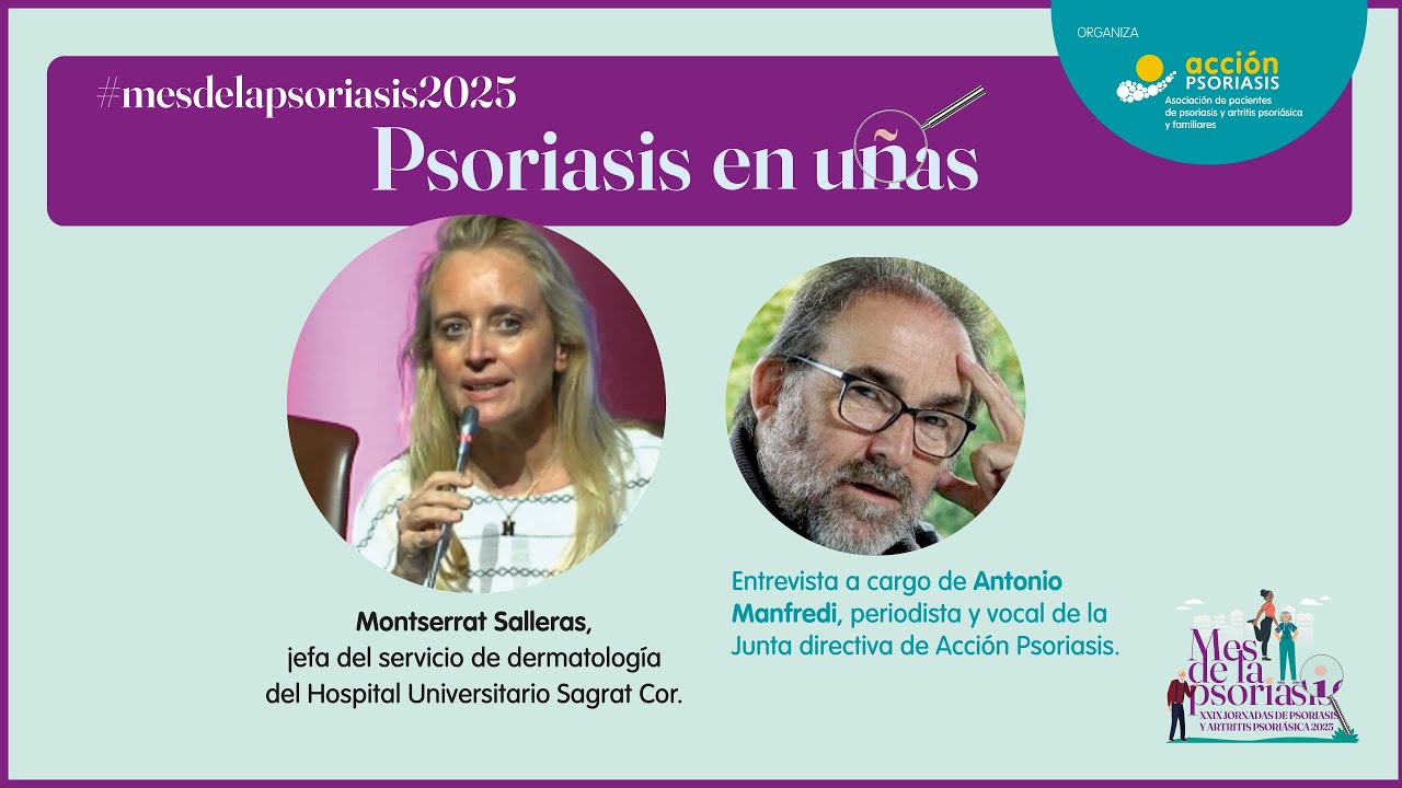 Psoriasis en Uñas: ¿Cómo Identificarla? Tratamiento, Cuidados y Relación con la Artritis Psoriásica