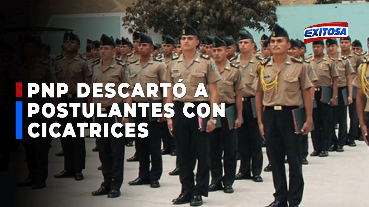 🔴🔵Huancayo: Denuncian que PNP descartó a postulantes por tener cicatrices o caspa