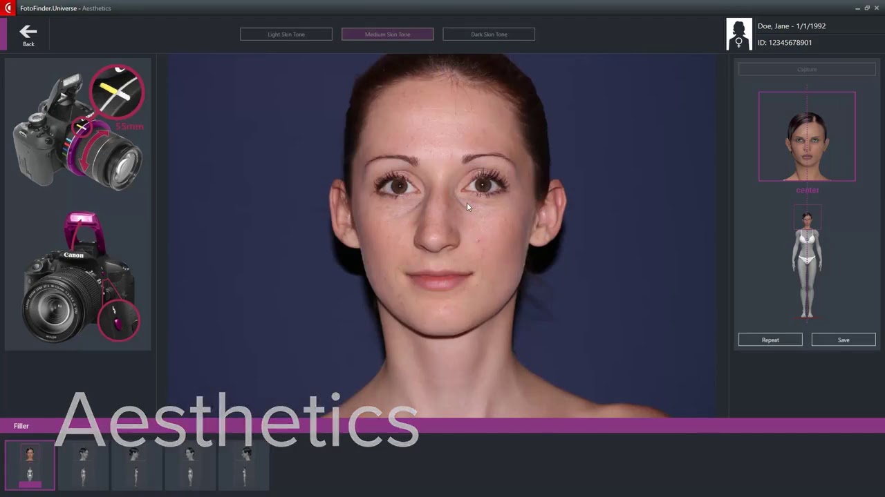 Skin cancer detection with FotoFinder bodystudio ATBM®