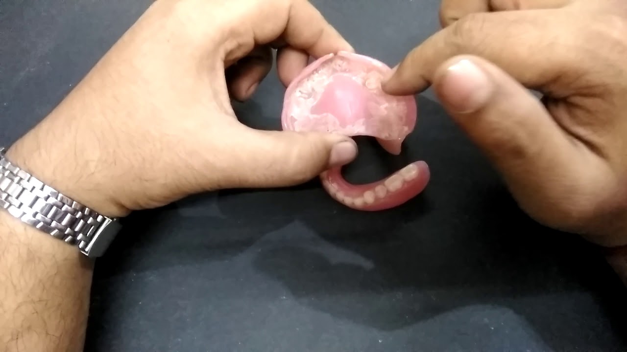 SOFT LINER THE ULTIMATE WAY TO SOLVE DENTURE PROBLEM