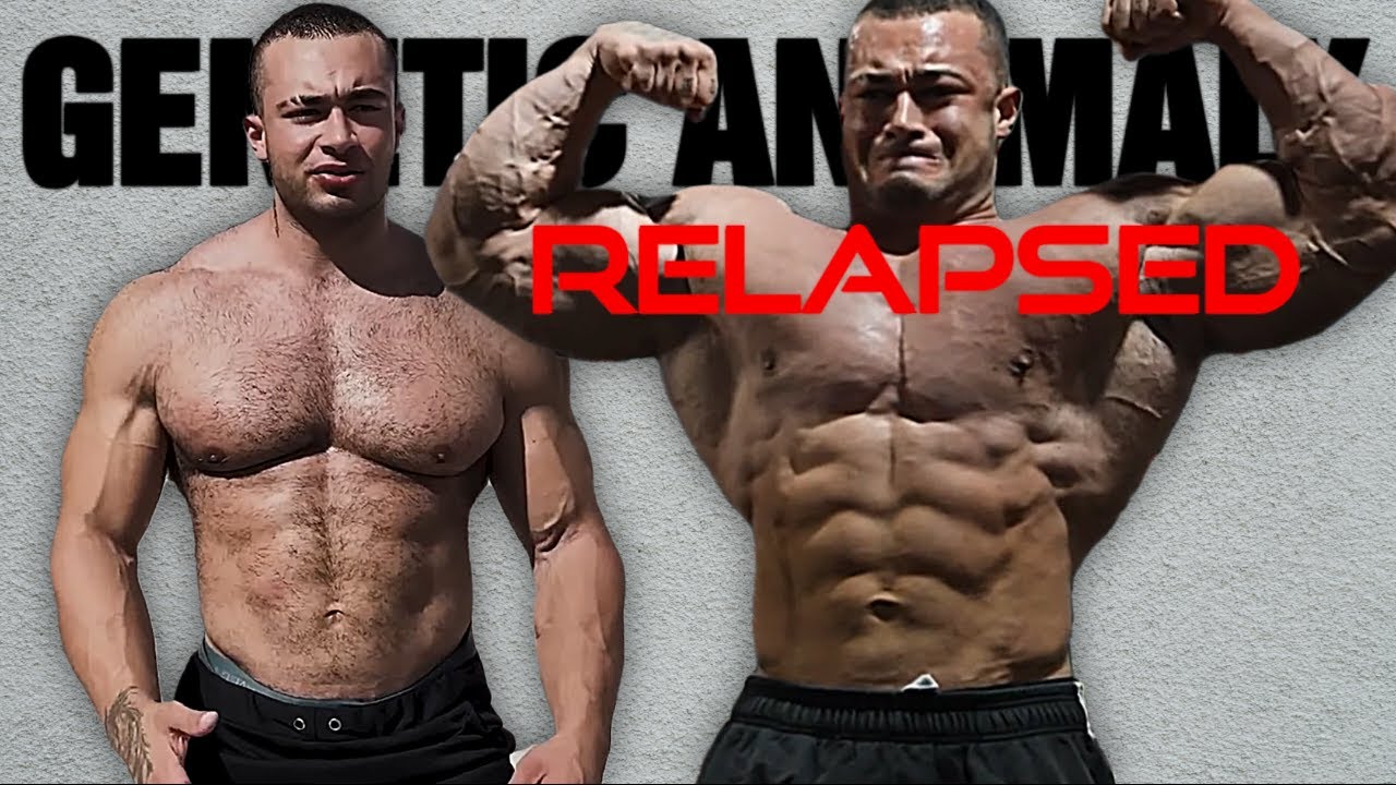 Genetic Anomaly Relapsed
