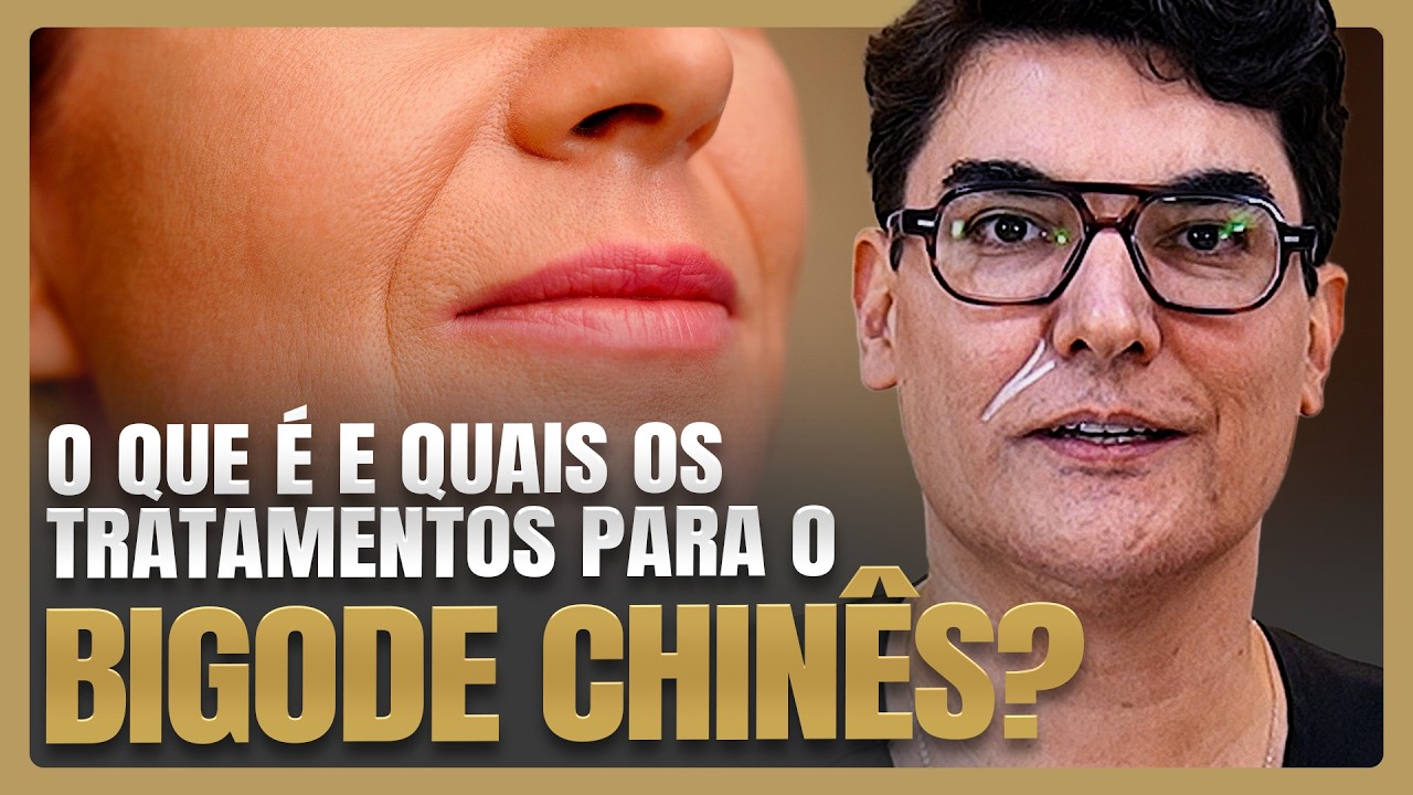 O que é e quais os tratamentos para o BIGODE CHINÊS?
