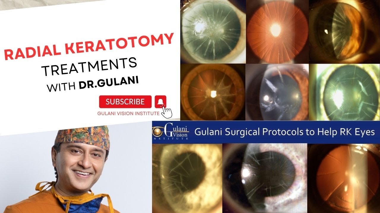 Radial Keratotomy Complications and Treatments : Dr.Gulani explains his Mindset and Approach