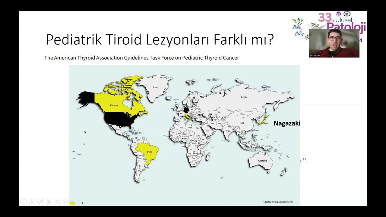 Zor Bir Tiroid Olgusu