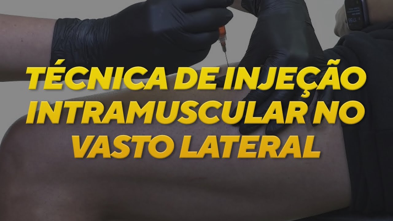 Técnica de injeção intramuscular no músculo vasto lateral