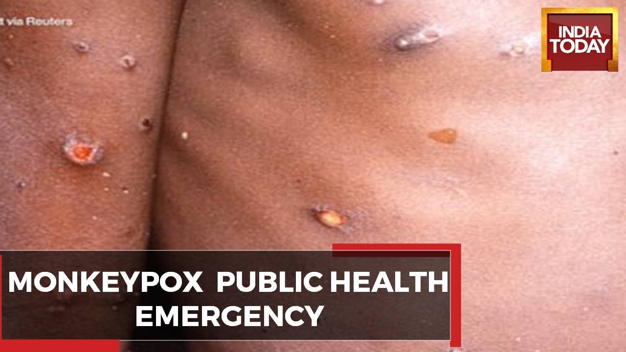 6 PM Prime: Monkeypox In India, Attempt To Disrupt Kanwar Yatra & Death Threat To Vicky-Katrina