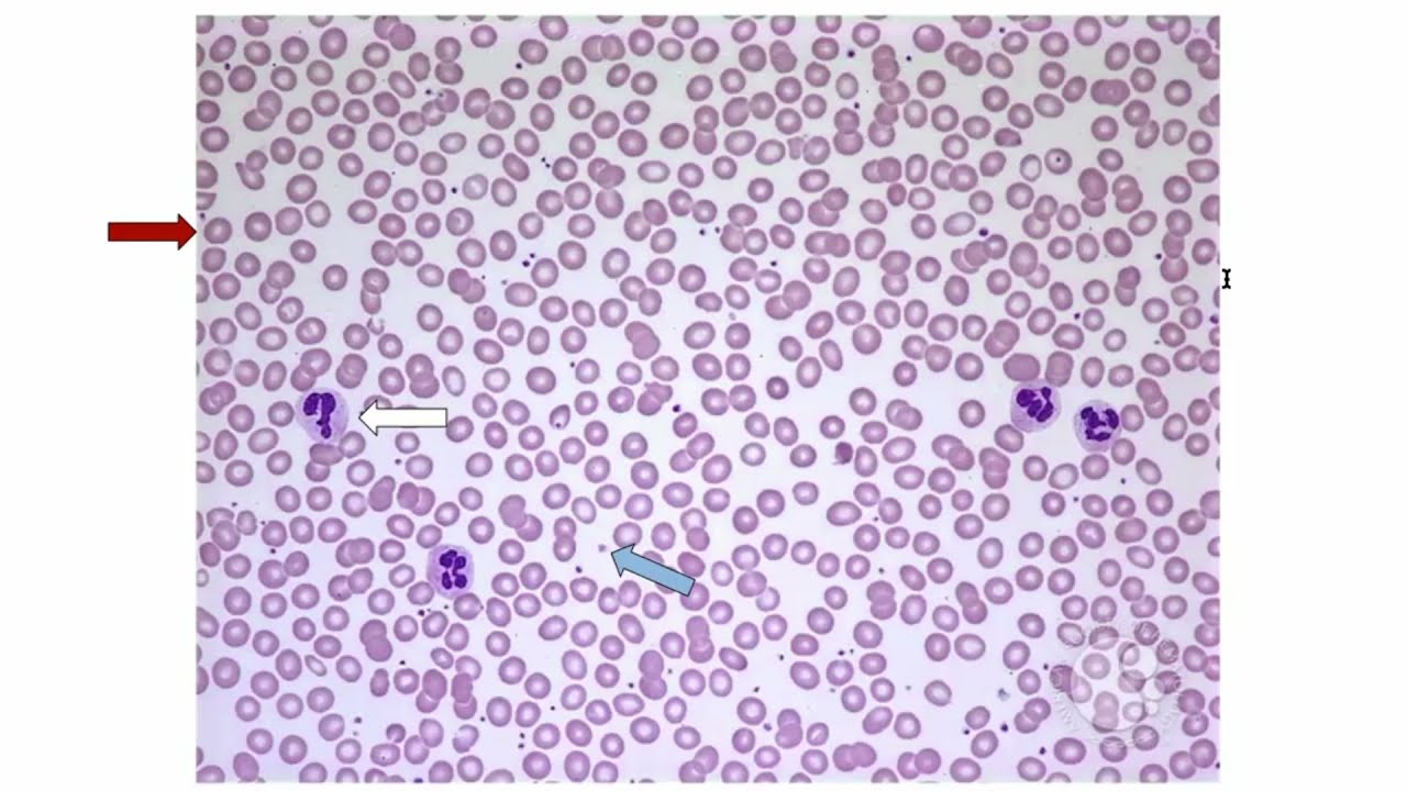 Hematology for the USMLEs: Normal Peripheral Smear Overview