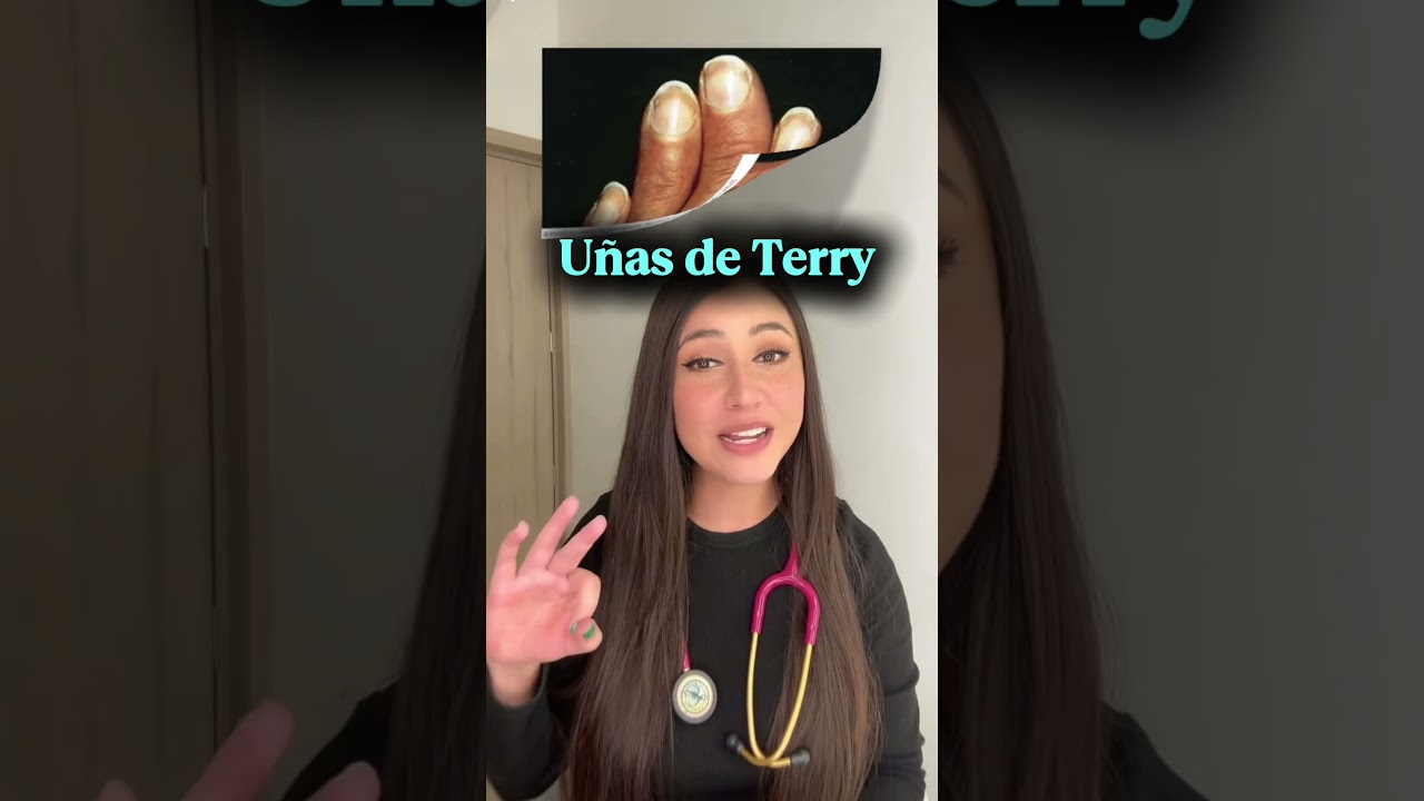 Enfermedades que podemos ver en las u&ntilde;as👩🏻&zwj;⚕️ #u&ntilde;as #acropaquia #interesante #informaci&oacute;n #medicina