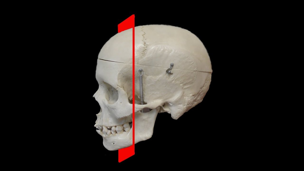 Руководство Layperson по сканированию CT Sinus