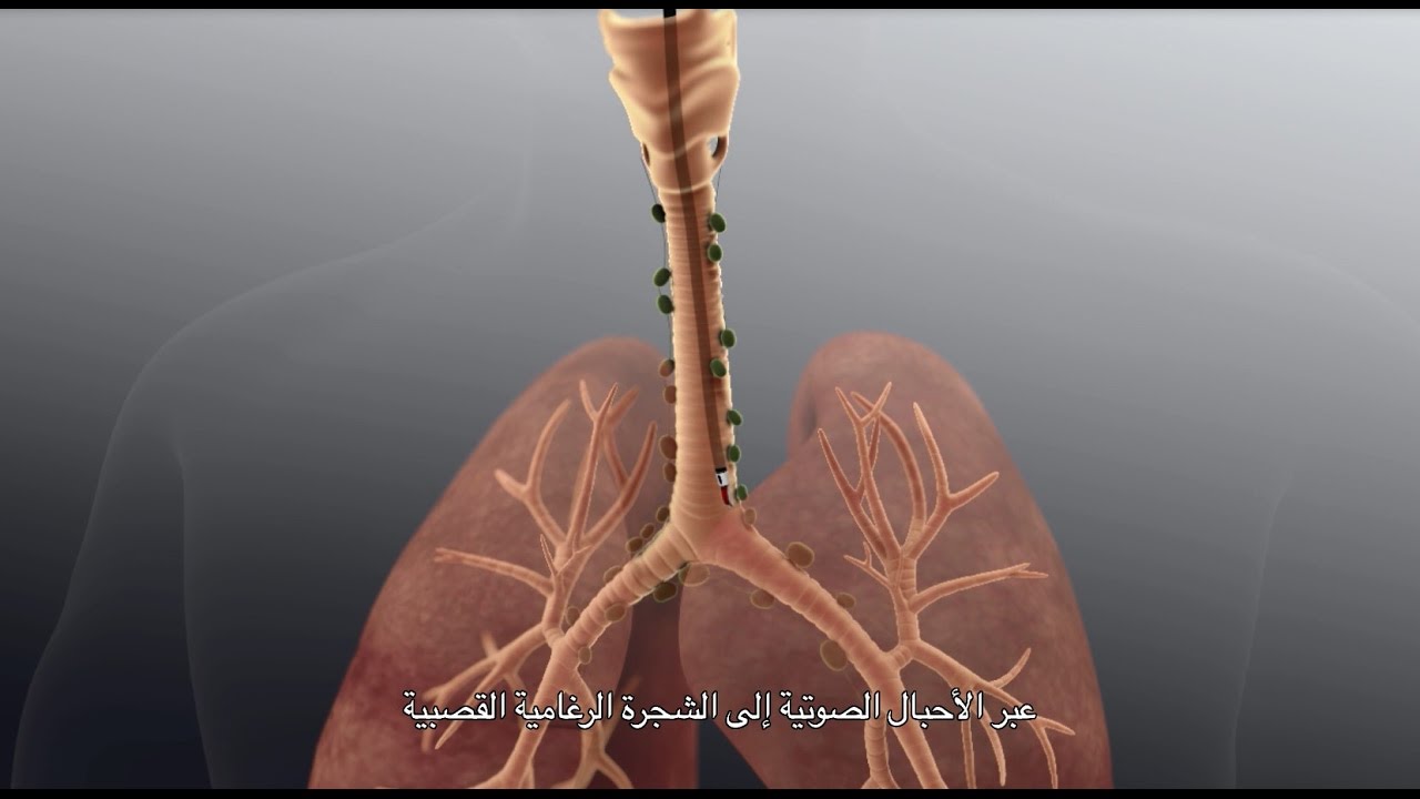 Advanced Bronchoscopy for Lung Diagnosis