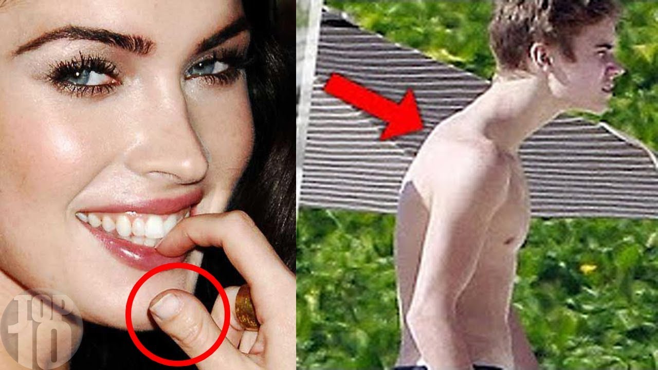 10 Celebrities With Physical Deformities