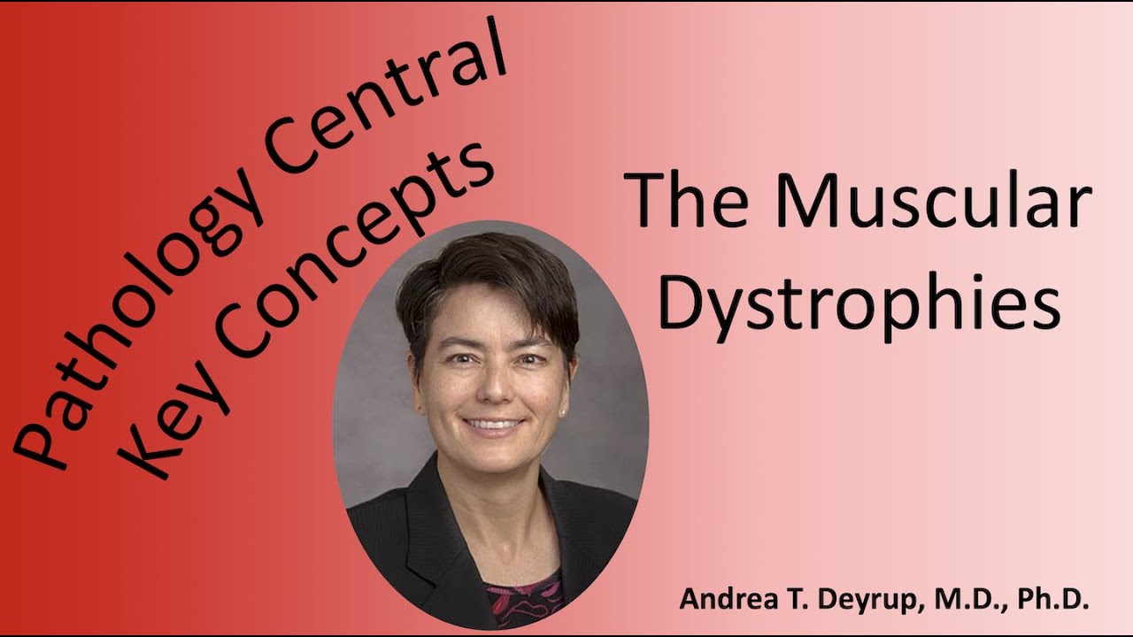 Medical School Pathology: Pathophysiology of Muscular Dystrophy
