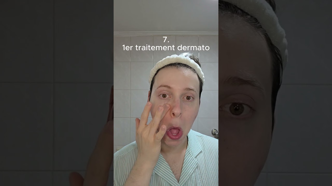Routine du soir pour peau mixte + rosacée !😉 