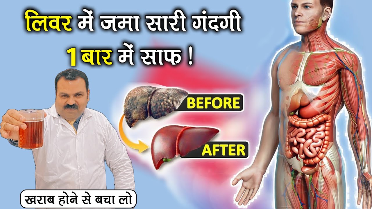फैटी लिवर ग्रेड 1, 2, 3, लीवर का बढ़ जाना, लिवर की गर्मी, भूख ना लगना, पेट का फूलना सब जड़ से ठीक