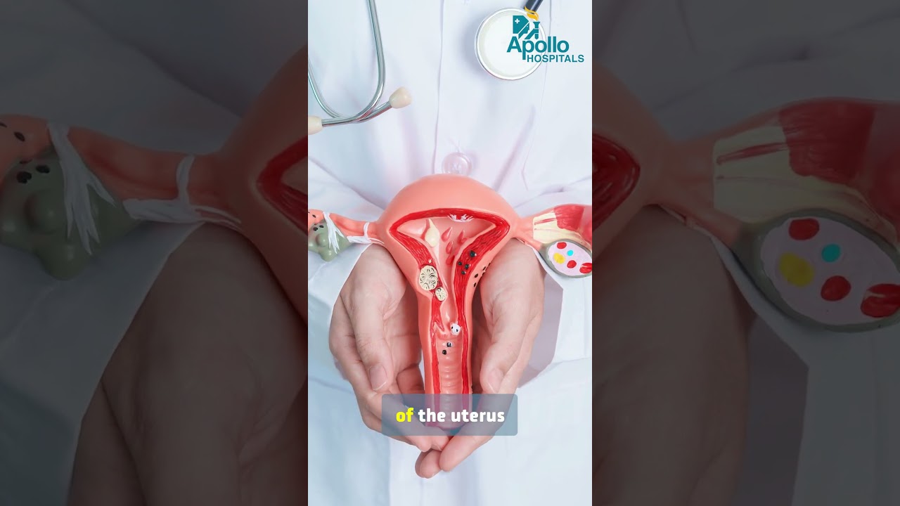 Dr. Preeti Prabhakar |Implantation Bleeding Explained: Causes & Timing | Apollo Hospitals