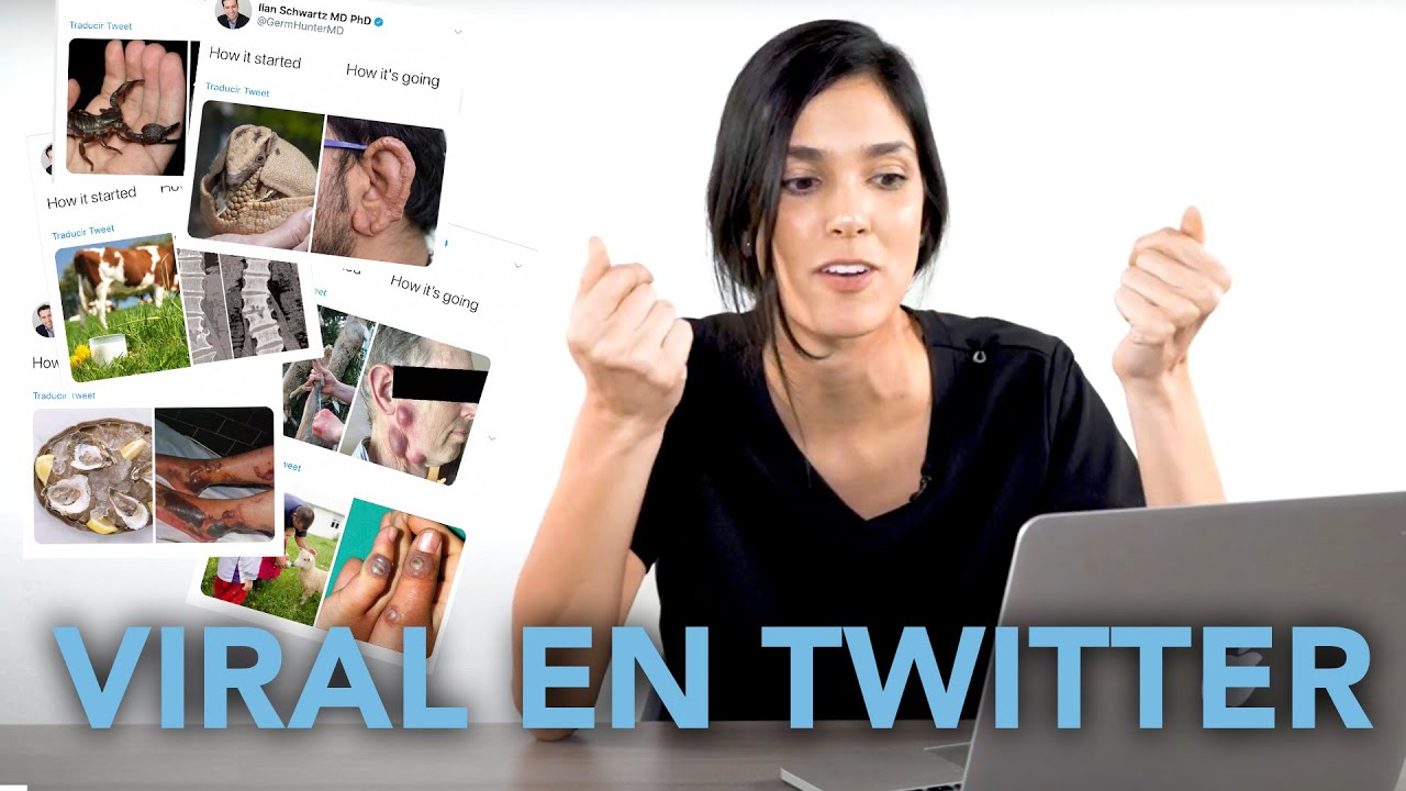 Las 9 enfermedades más raras | HILO VIRAL DE TWITTER - Dra. Jackie