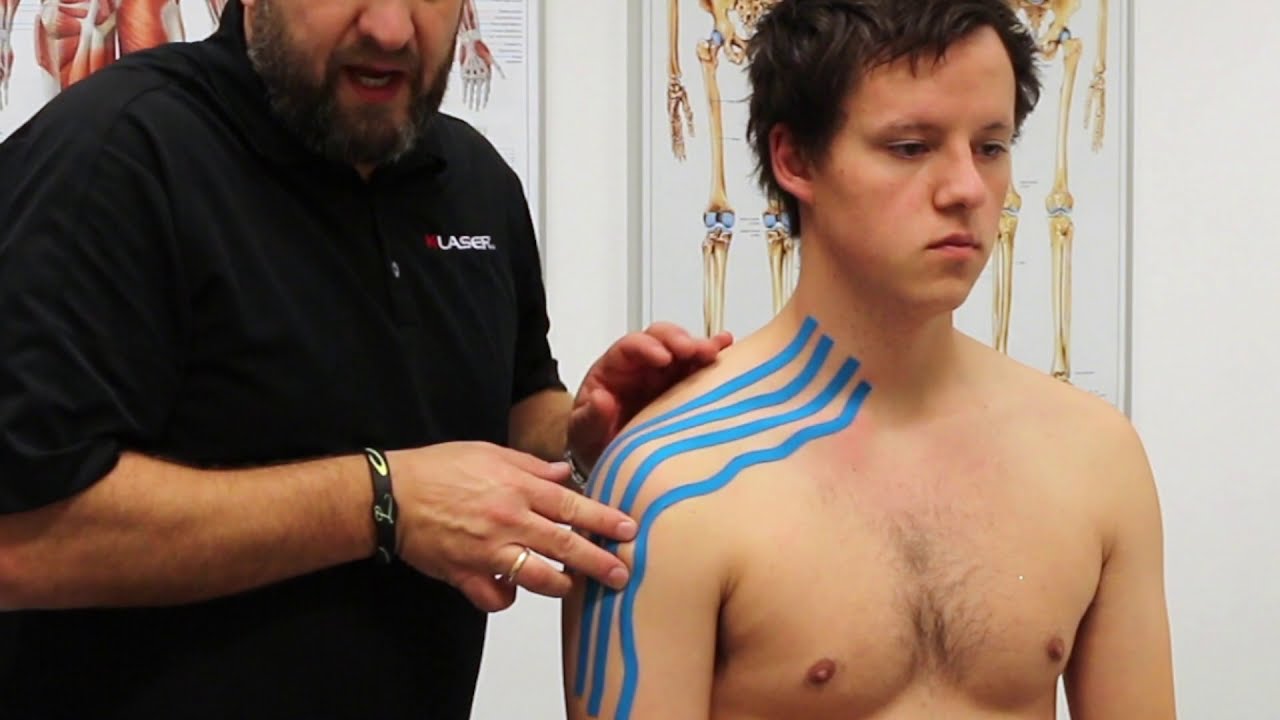 Kinesiologi tape for effusion i skulder