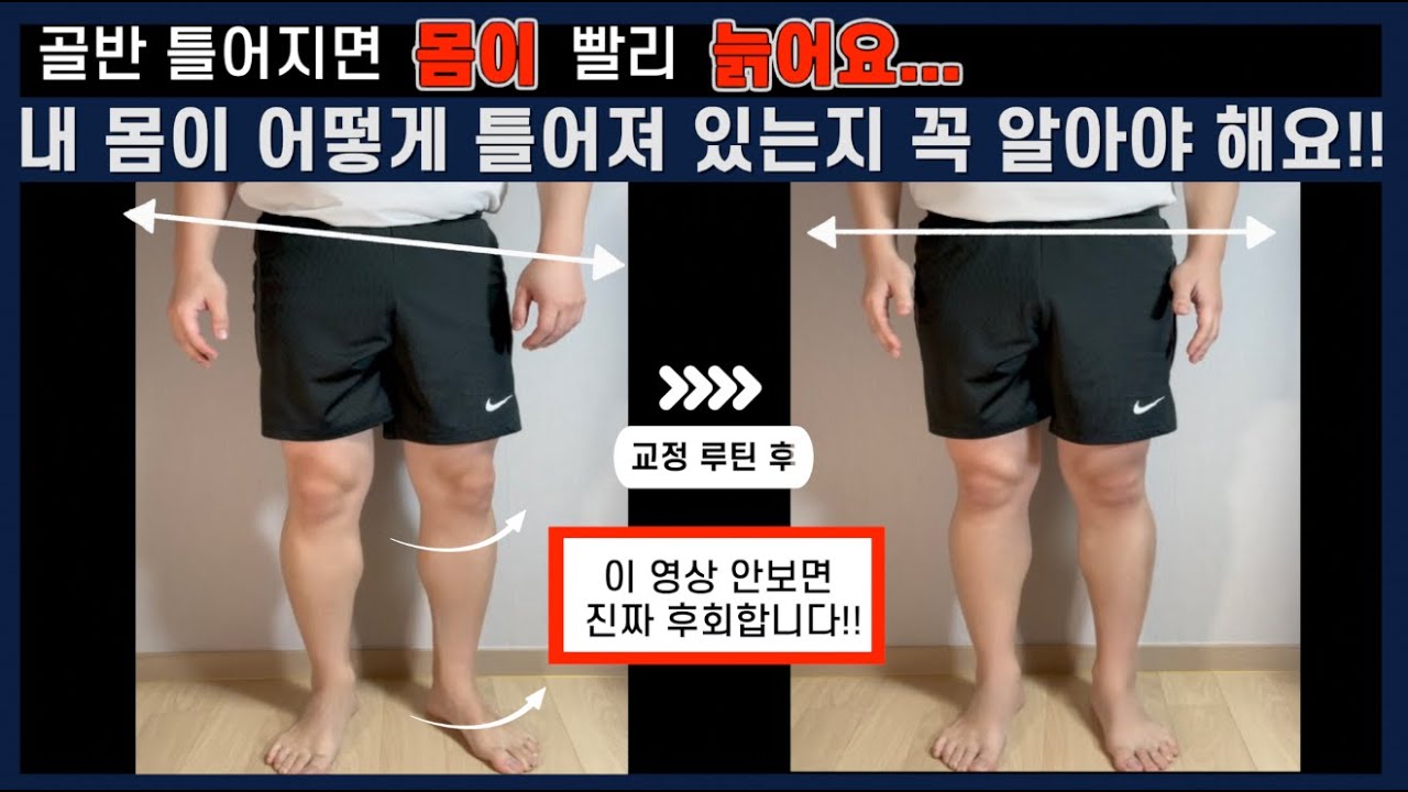아무나 할 수 있는 골반 틀어짐 자가 진단 루틴, 골반 자가 교정법ㅣ허리통증, 골반통증, 골반비대칭, 골반틀어짐ㅣ