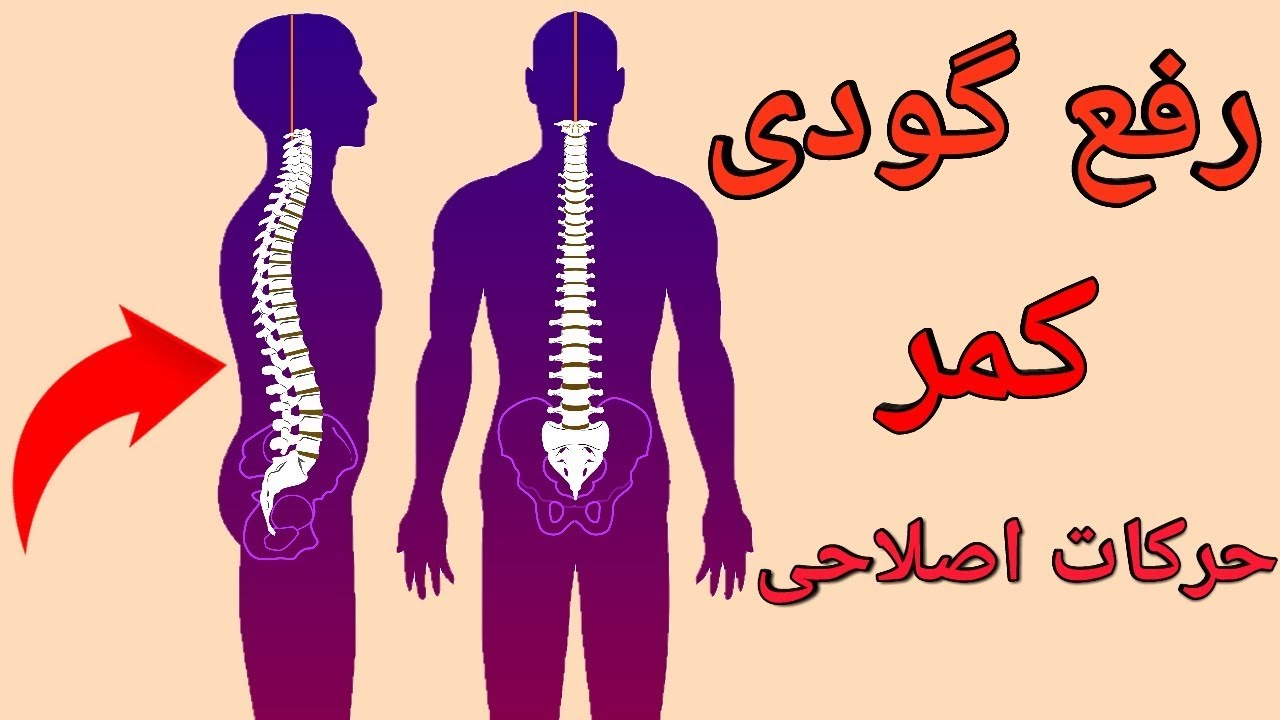 آموزش رفع گودی کمر با حرکات اصلاحی