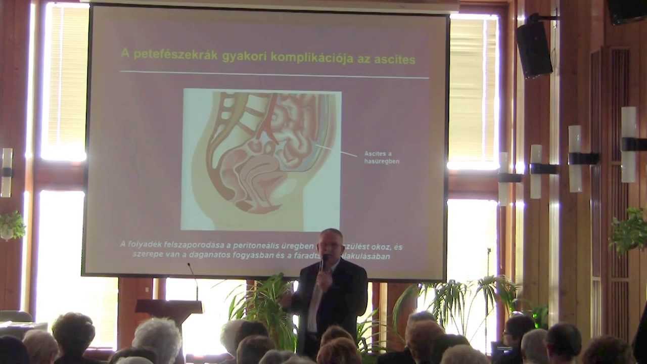 Előrehaladás a petefészekrák felismerésében és gyógyításában