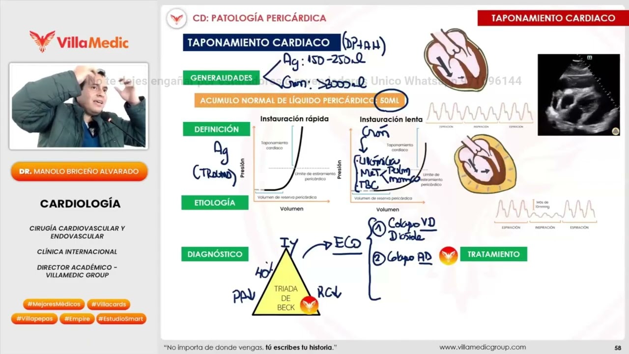 Patología Pericárdica 2025: Pericarditis, Taponamiento y Pericarditis Constrictiva | VILLAMEDIC