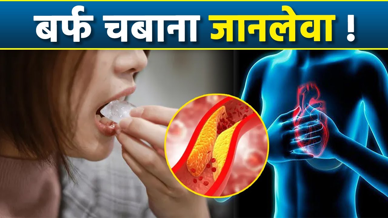 बार बार बर्फ खाने से Pagophagia Disorder, Reason Treatment जानना जरूरी | Boldsky