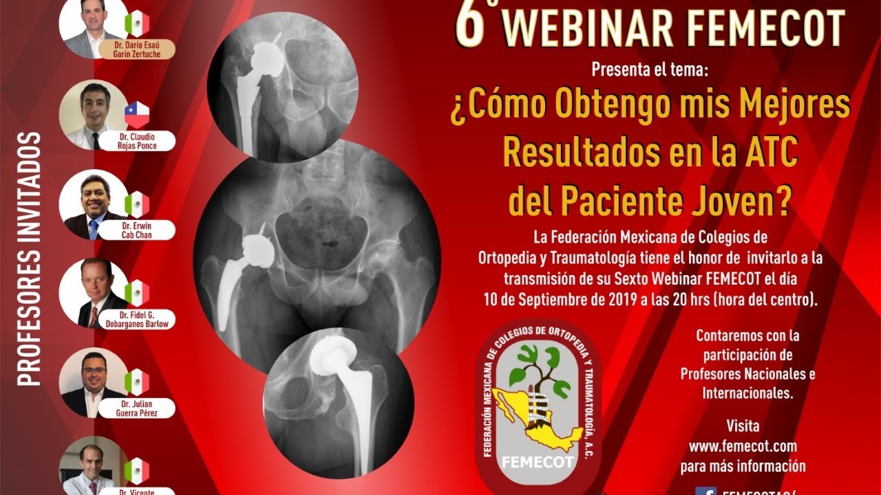 6º Webinar FEMECOT: ¿Cómo Obtengo mis Mejores Resultados en la ATC del Paciente Joven?