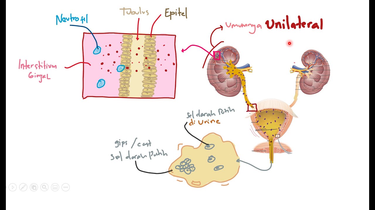 Patofisiologi - Cidera Ginjal Akut Prerenal / Azotemia / Acute Kidney Injury