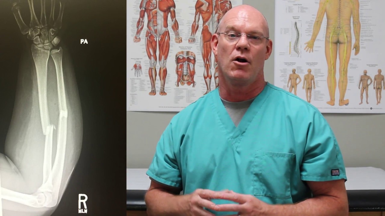 Open Forearm Fracture | Fracture Friday Episode 1