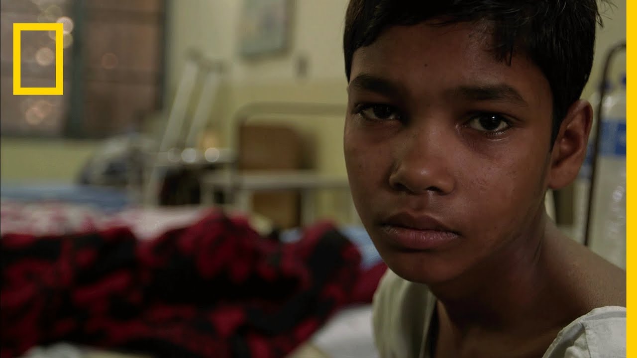 En Inde, les lépreux sont traités comme au temps du Christ