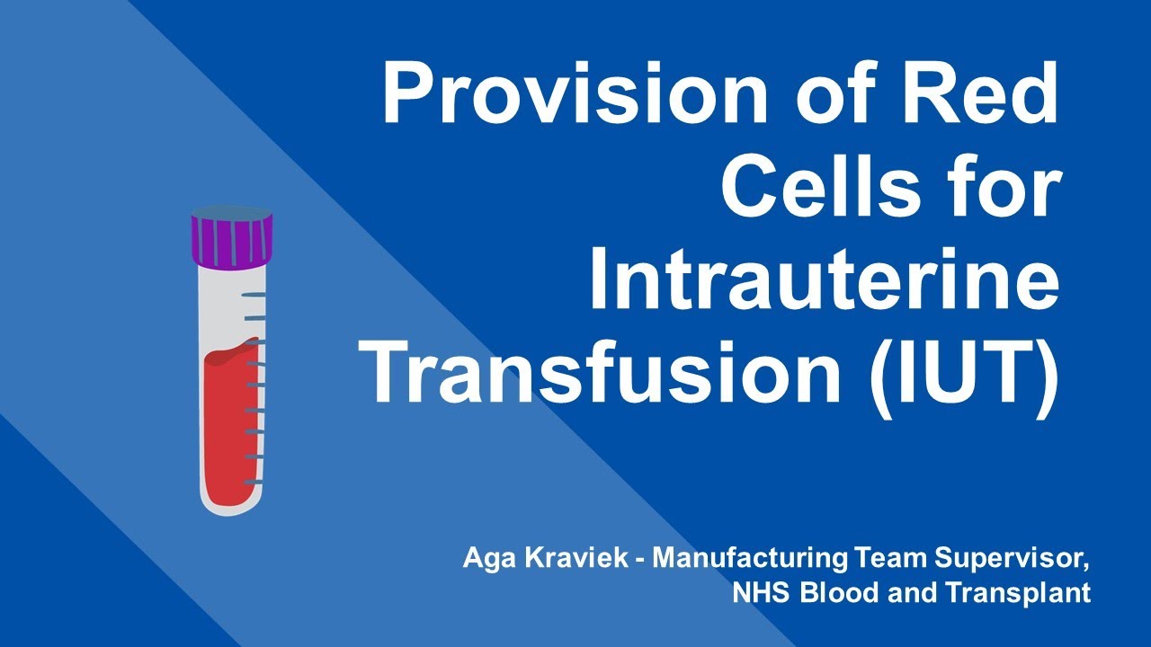 London RTC Education Session - Provision of Red Cells for Intrauterine Transfusion (IUT)