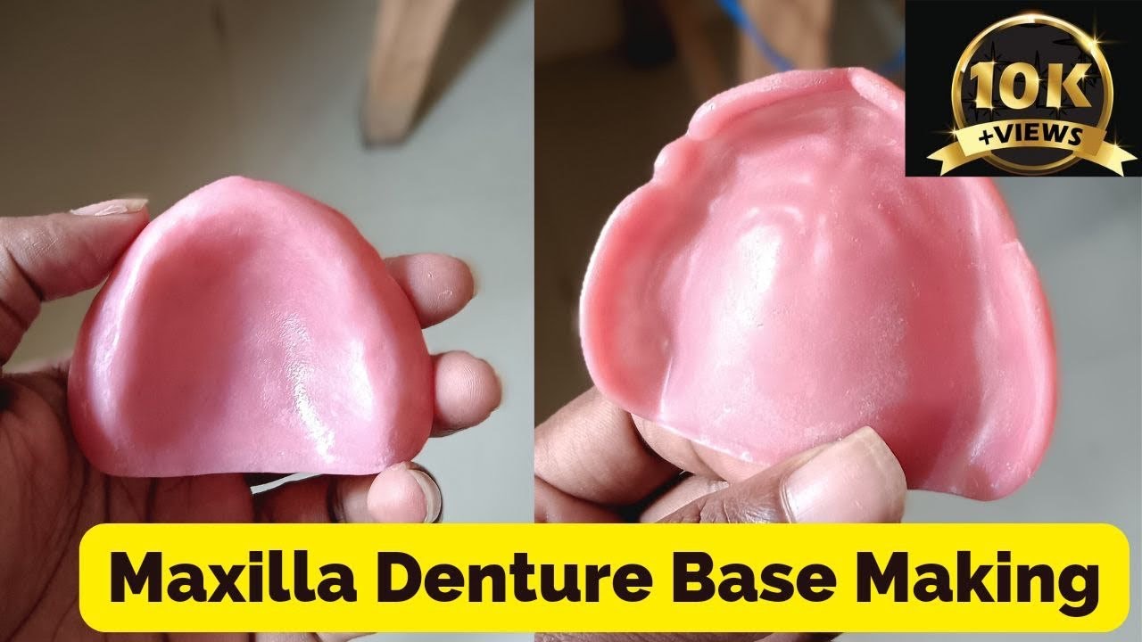 How to make Denture Base by Sprinkle Method | Cold cure Acrylic Resin