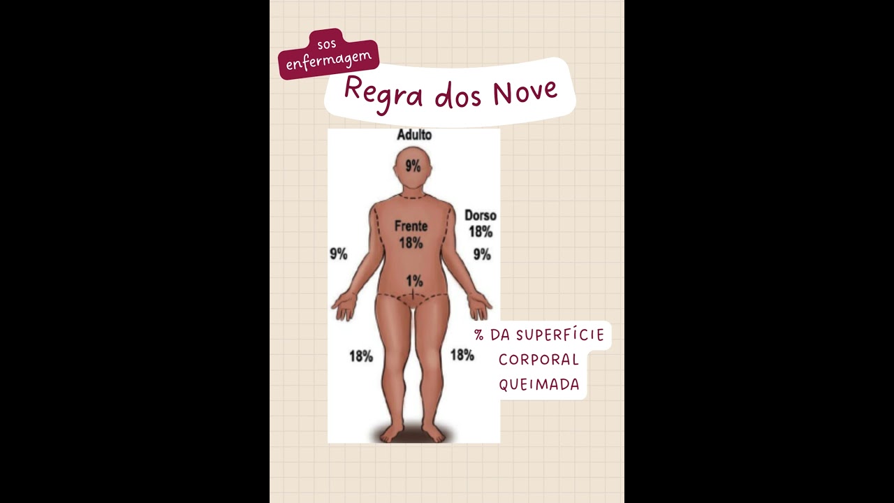 Regra dos Nove #concurso #saude #enfermagem #medicina #queimaduras