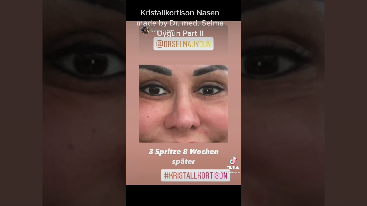 Kristallkortison Behandlung made by Dr. med. Selma Uygun