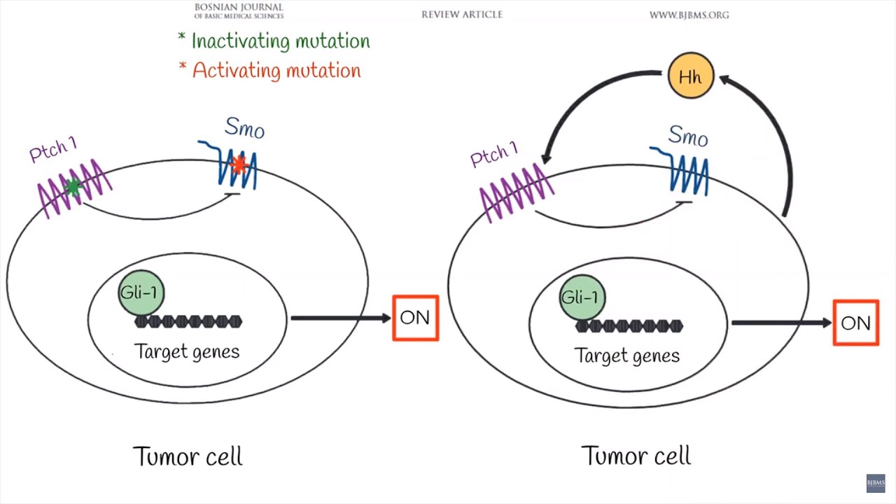 The role of the Hedgehog signaling pathway in cancer: A comprehensive review, VIDEO ABSTRACT