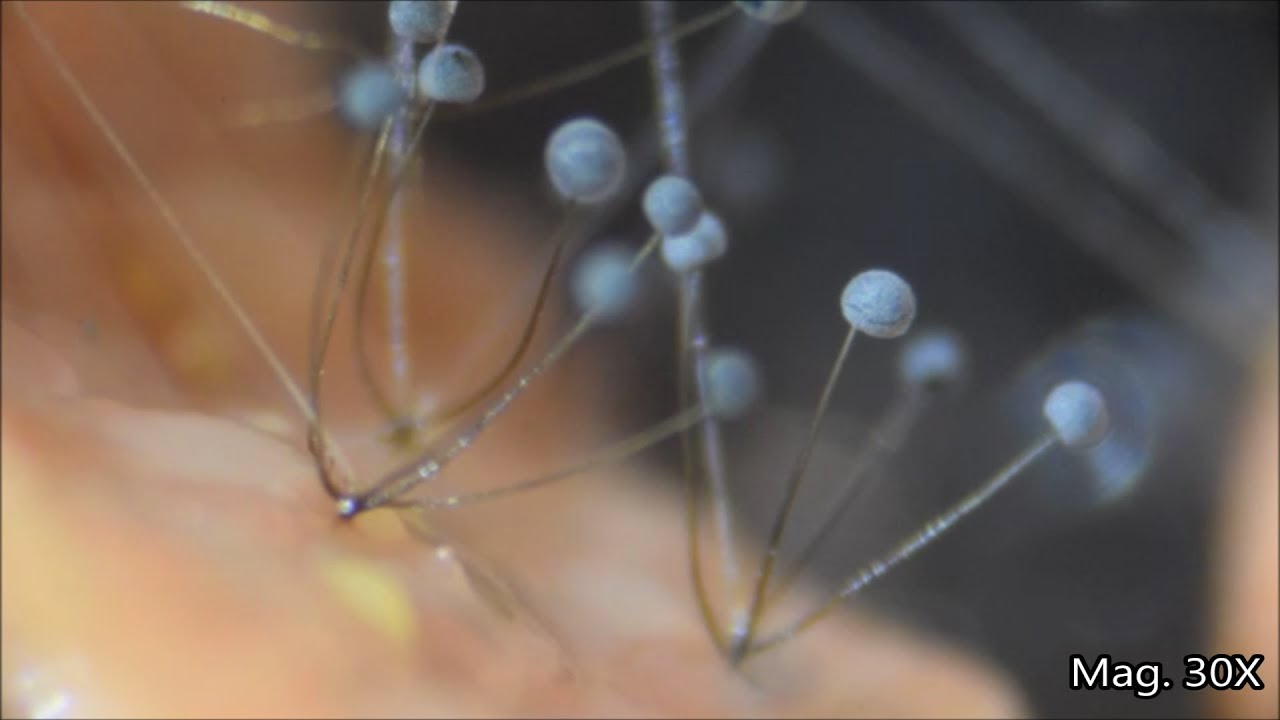 Hot Dog Mold under the Microscope