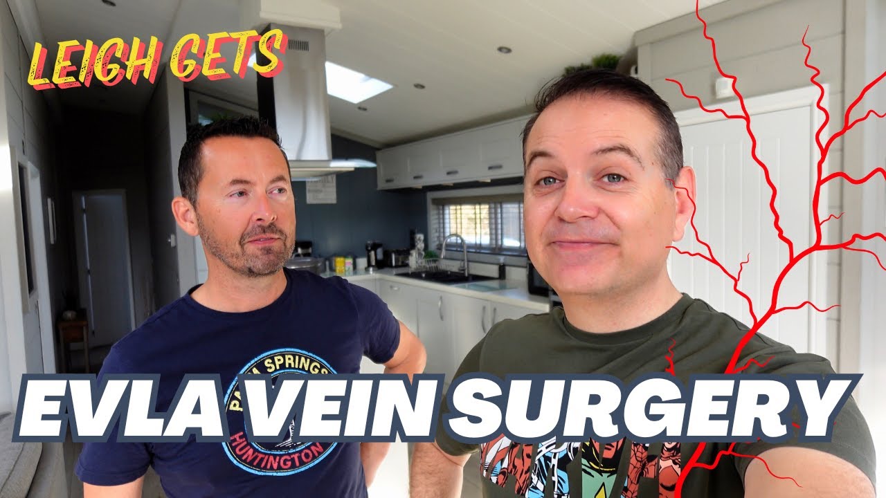 I Have my varocoise Veins Destroyed | EVLA Laser Vein Surgery