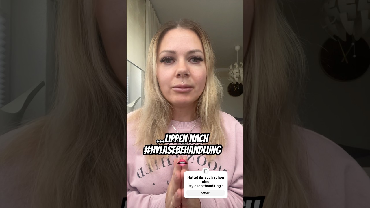Update Hylasebehandlung👄