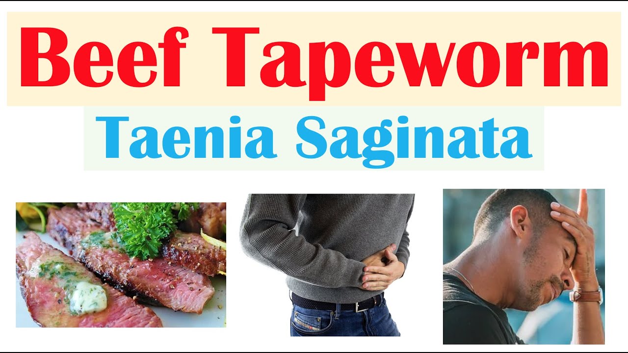Beef Tapeworm (Taeniasis) | How It Infects, Signs & Symptoms, Diagnosis, Treatment, Prevention