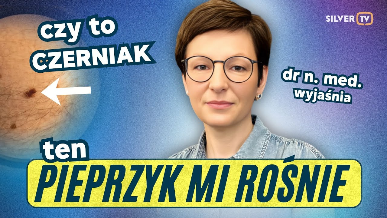 Znamiona, pieprzyki, czerniak – jak się badać i chronić?