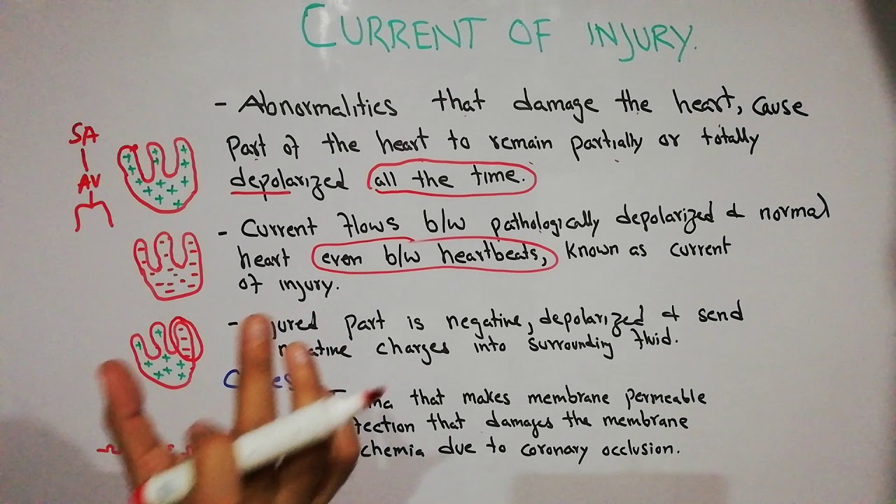 CVS physiology 38. Current of injury.